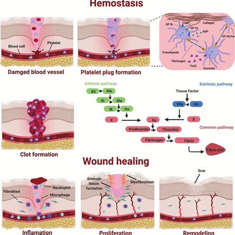 Schematic representation of hemostasis and other 3 stages of the wound ...