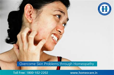 Skin Allergy Treatment In Homeopathy Homeocare International