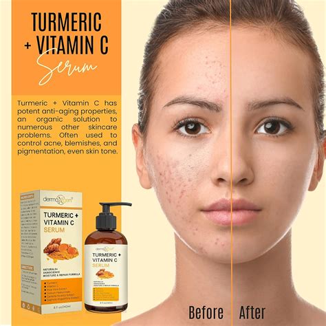 Suero facial de cúrcuma vitamina C tratamiento orgánico para el acné