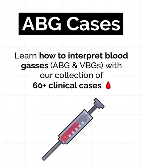 Acute Coronary Syndrome Acs Acute Management Abcde Geeky Medics