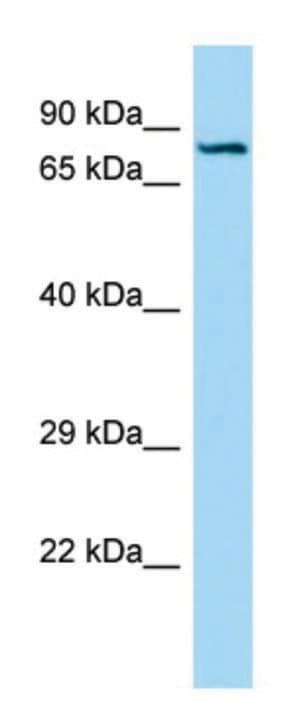 NONANOIC ACID 2 2 2 TRICHLORO 1 3 4 IODO PHENYL THIOUREIDO ETHYL