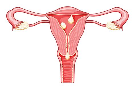 Uterus In Female Reproductive System Cervical Cancer Diagram Latin