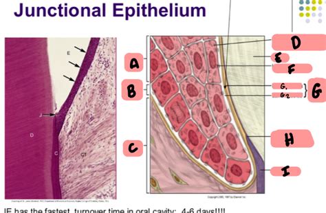 Junctional epithelium Diagram | Quizlet