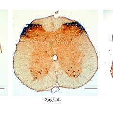 Photomicrographs Showing Regenerated Nerve Cross Sections Of A