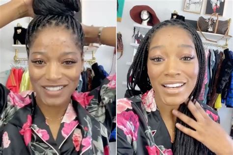 Keke Palmer Shows How She Covers Her Extreme Acne In Makeup Tutorial