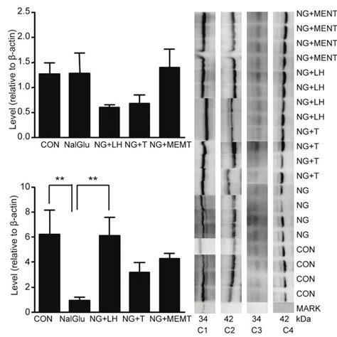 Hormonal regulation of 11βHSD1 and 11βHSD2 mRNA levels The samples