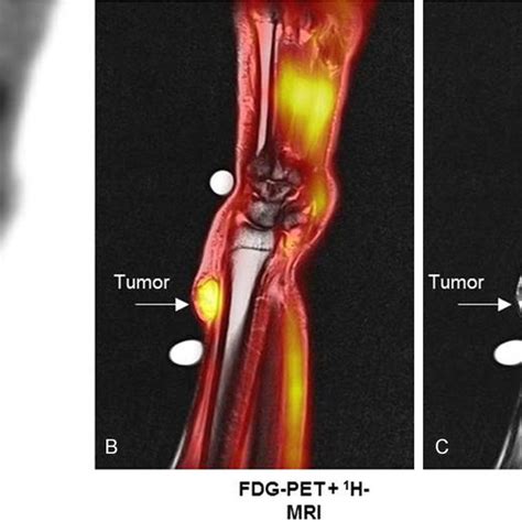 Transaxial Images Of Right Front Leg Showing The Liposarcoma Note The