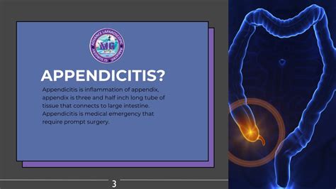 PPT Laparoscopic Appendectomy Surgery In Faridabad PowerPoint