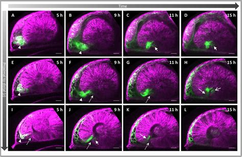 Optic Fissure Margin Morphogenesis Sets The Stage For Consecutive Optic