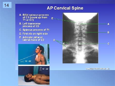 1 Cervical Spine Rtec 124 Week 6 Rev