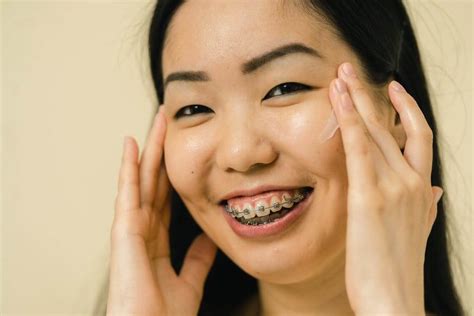 Can Braces Fix An Underbite Yes Heres How Wardlaw Orthodontics