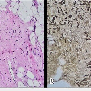 Histopathological images in the H&E stain (A) and immunohistochemistry ...