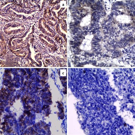 Trans Glutaminase 2 Tgm2 Immunohistochemical Expression In Download Scientific Diagram