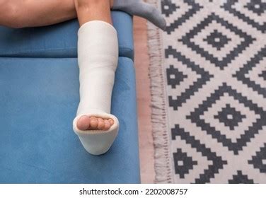 Broken Leg Ankle Foot Splint Bandages Stock Photo 2202008757 Shutterstock