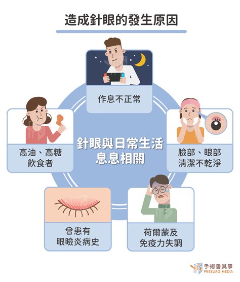 針眼一直不消要開刀？原因、前兆、症狀、治療一次看