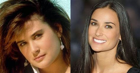 Chatter Busy Demi Moore Plastic Surgery