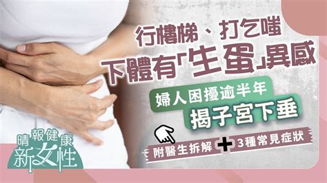 健康新女性︳行樓梯打乞嗤下體有「生蛋」異感 婦人困擾逾半年揭子宮下垂︳附3種常見症狀 晴報 健康 女性疾病 D220907