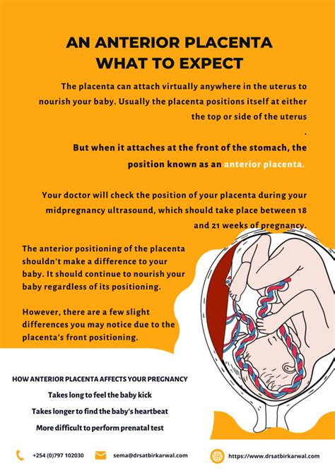 Anterior Placenta What To Expect Dr Satbir Karwal