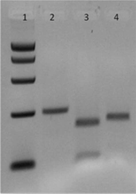 Agarose Gel Electrophoresis Showing The Restriction Fragment Analysis