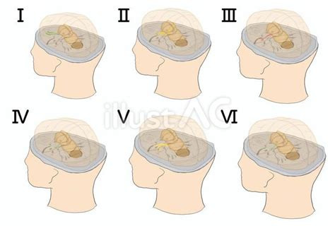 内頭蓋底の孔と脳神経の走行イメージ 前半イラスト No 23679166｜無料イラスト・フリー素材なら「イラストac」