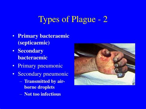 Ppt The Black Death Powerpoint Presentation Free Download Id5894968