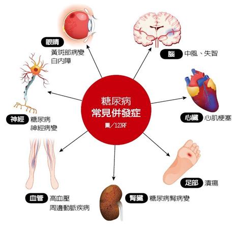 糖尿病有哪些併發症？會致命嗎？做好7事預防｜新陳代謝｜醫療｜元氣網