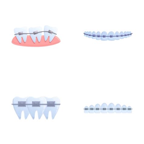 Premium Vector Brace System Icons Set Cartoon Vector Orthodontic