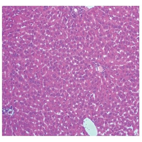 Section Of The Liver Tissue Of Control Group Showing Normal Histology