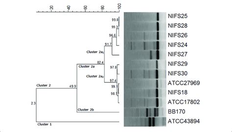 Repetitive Extragenic Palindromic Sequence Based PCR REP PCR