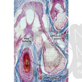 Man Sebaceous Gland Vertical Section X Sebaceous Gland