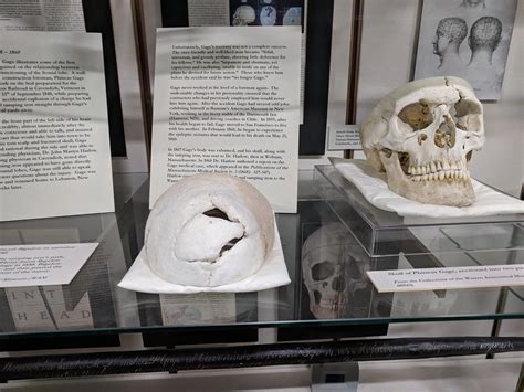 Phineas P Gage 4