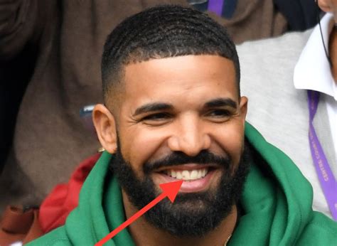 Drake has something in his teeth while he roots for Serena Williams