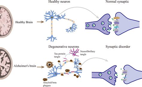 Frontiers Epigenetic Regulation Of Synaptic Disorder In Alzheimers