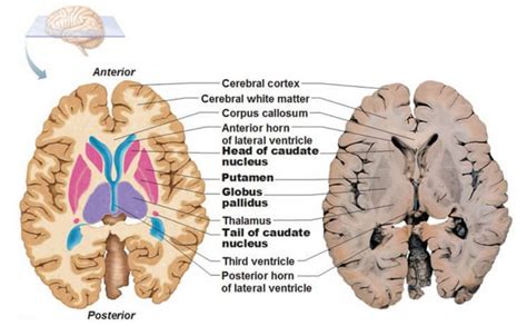 Basal Ganglia Anatomy Function Stroke And Disorders Updated In 2022