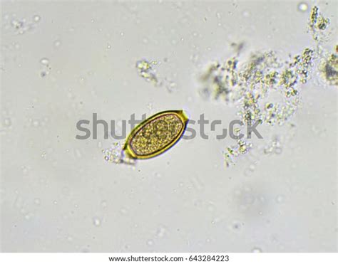 Egg Trichuris Trichiura Whipworm Stool Analyze Stock Photo