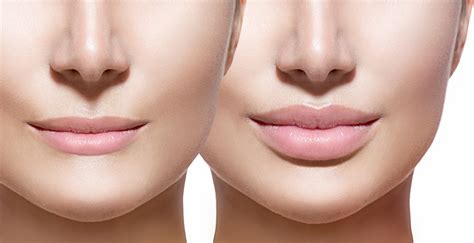 How To Make Your Lips Look Fuller 3 Options For Plump Lips