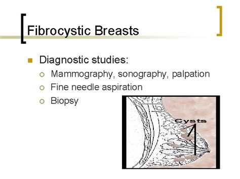 Womens Health Fibrocystic Breasts Endometriosis Polycystic Ovary Syndrome