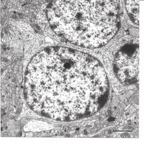 Granule Cells Ultrastructure Of Control Rat Olfactory Bulb With