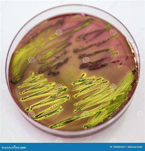 Metallic Green Sheen Characteristic Colonies Of Escherichia Coli On Eosin Methylene Blue Aar Emb