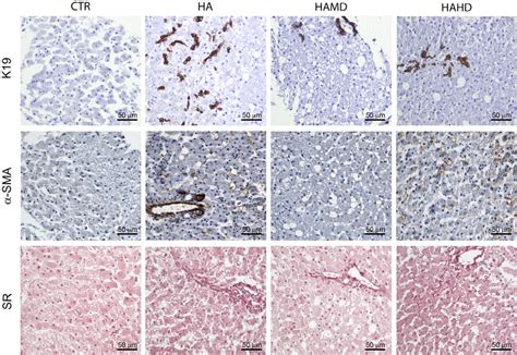 Histology And Immunohistochemical Staining Of Liver Biopsies From 21 Download Scientific