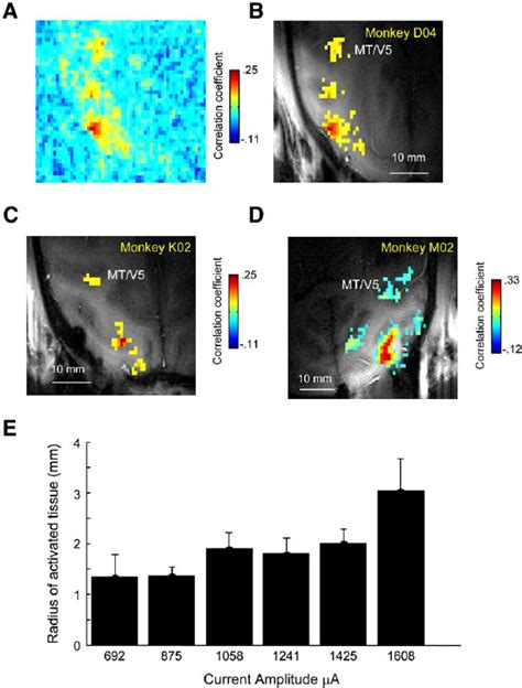 In Vivo Functional Connectivity Between V1 And MT V5 A Functional Map