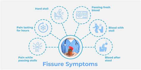 Fissure Treatment in Hyderabad