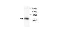 HBB / Hemoglobin Beta - LSBio