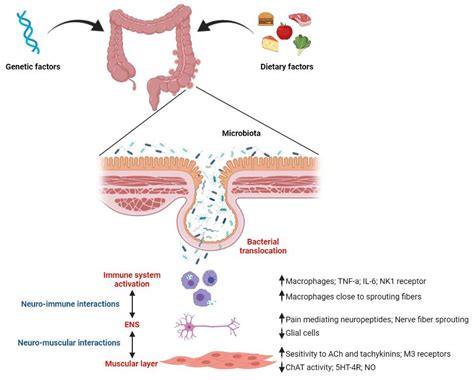 Ijms Free Full Text Pathophysiology Of Diverticular Disease From Diverticula Formation To