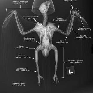 Proportions of fractures/luxations by anatomic site in Mississippi ...