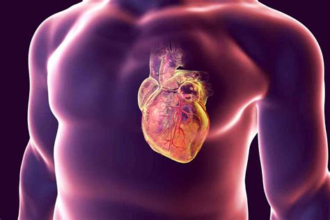 Il Rumore Aumenta Il Rischio Di Infarto Cosa Dice Lo Studio