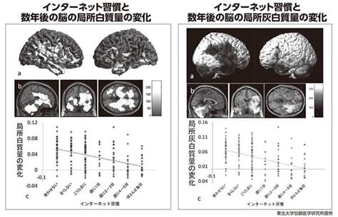 ゲーム依存症脳 破壊 – ゲームが脳に与える影響 文献 – ZUCICY