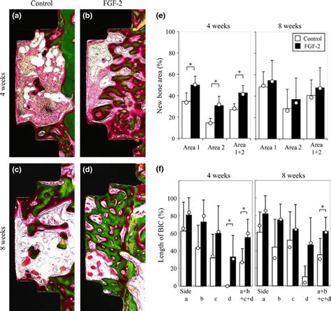 Histomorphometric Analysis Of New Bone Formation In Study 1 Ad