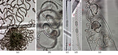 Some potentially toxic representatives of cyanobacteria from Lake ... 