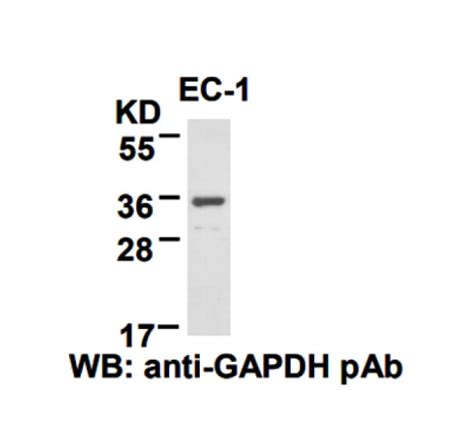 GAPDH PAb NewEast Biosciences GTPase And Oncogene